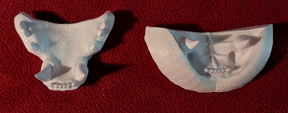 Small Jawset Top and Bottom Upcharge