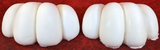 11.5" Wide 4-Toe Large Foam Paw Set